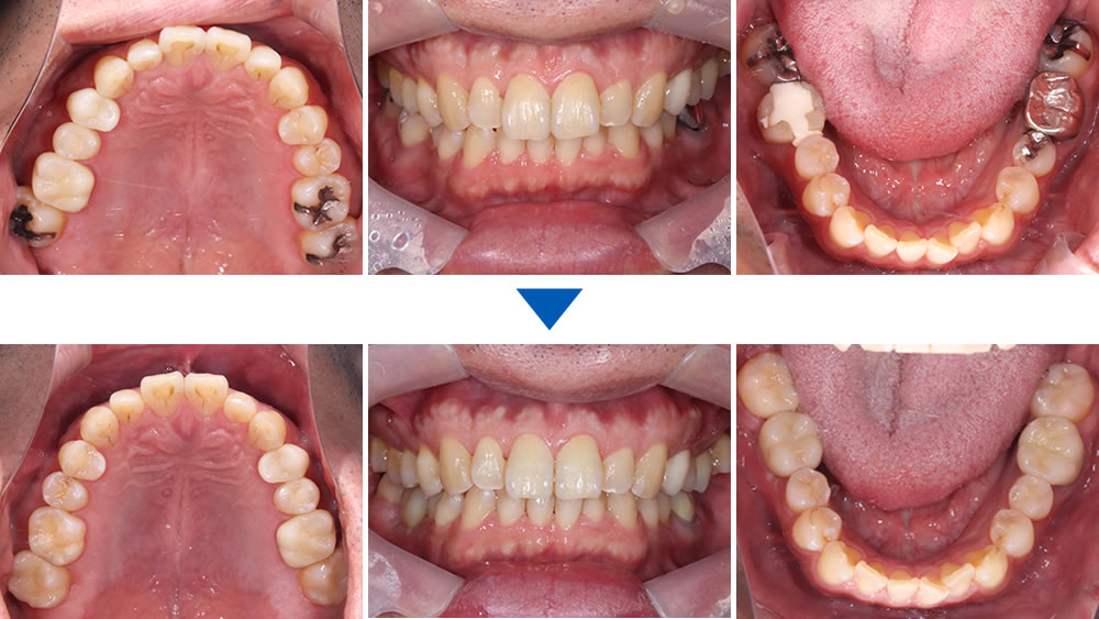 治療前後の比較