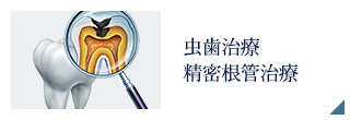 虫歯治療 精密根管治療