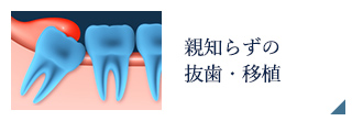 親知らずの抜歯・移植