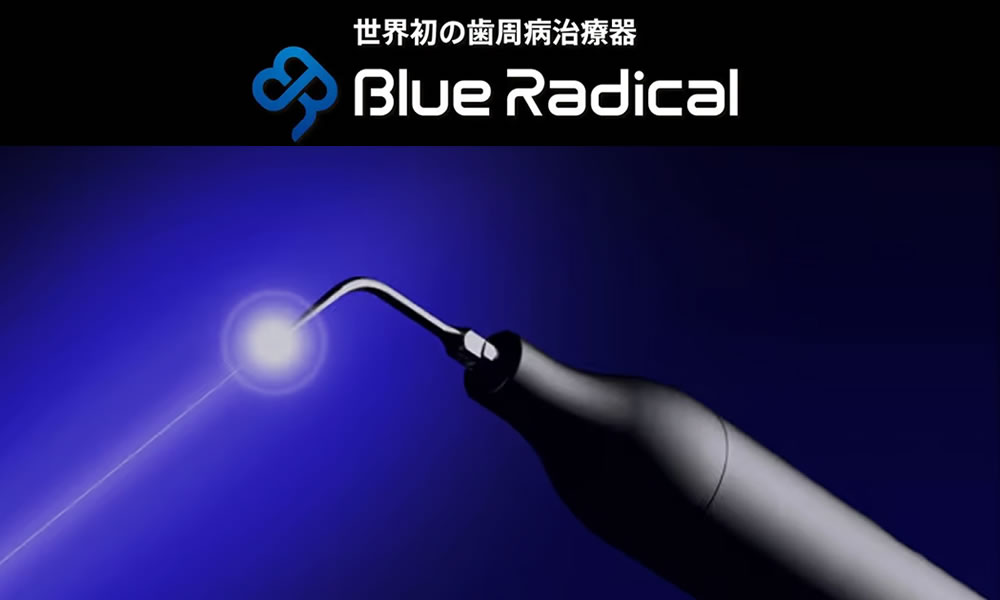 ブルーラジカルを使用した非外科的歯周病治療